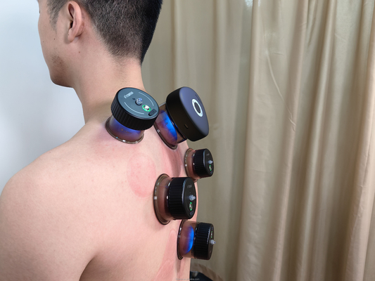Fitdash Smart Massage Cupping Vacuo Cupping Terapia de la máquina Conjunto con control de botón