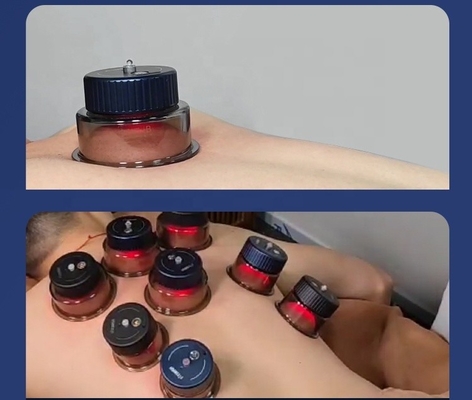 Cupa de respiración inteligente con fuerza de succión de -10 kPa a 60 kPa y 3.7V/150mAh