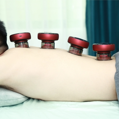 Experimenta el poder del dispositivo Fitdash Smart Electric Heat Cupping Vacuum para Gua Sha