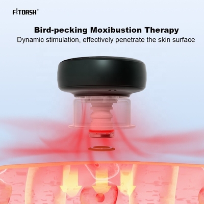 Experimenta el poder de la Cupping Infrarroja con el Dispositivo de Cupping Meridiano Digital Fitdash