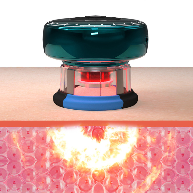 Fitdash TENS Smart Vacuum Copper Cargable y fácil de cargar para mejorar la circulación sanguínea