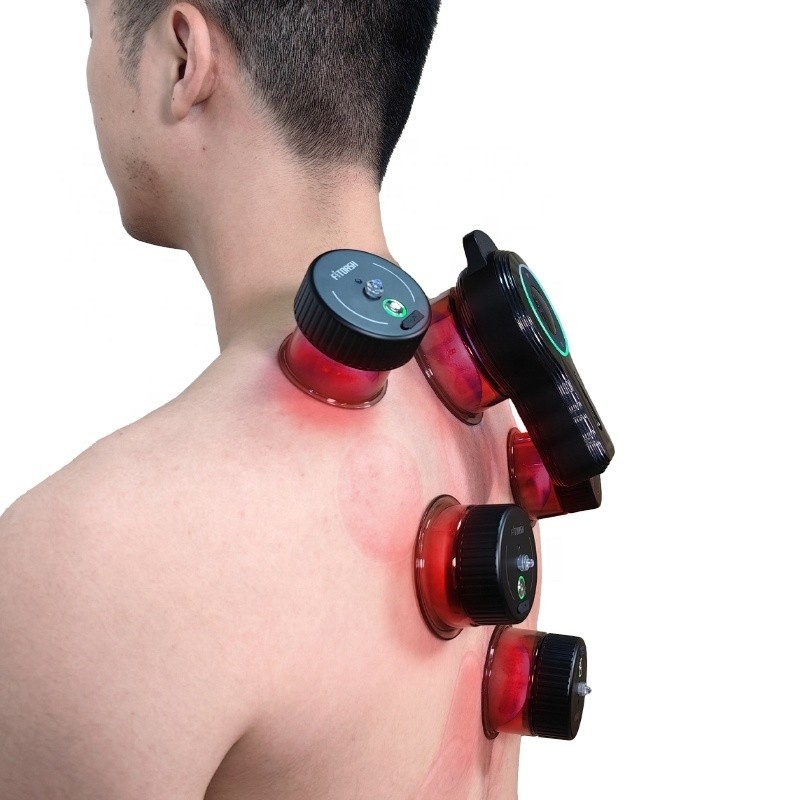 1 año de vida útil Fitdash Cupping inteligente de vacío eléctrico Cupping dinámico inteligente para el instrumento de raspado de spa