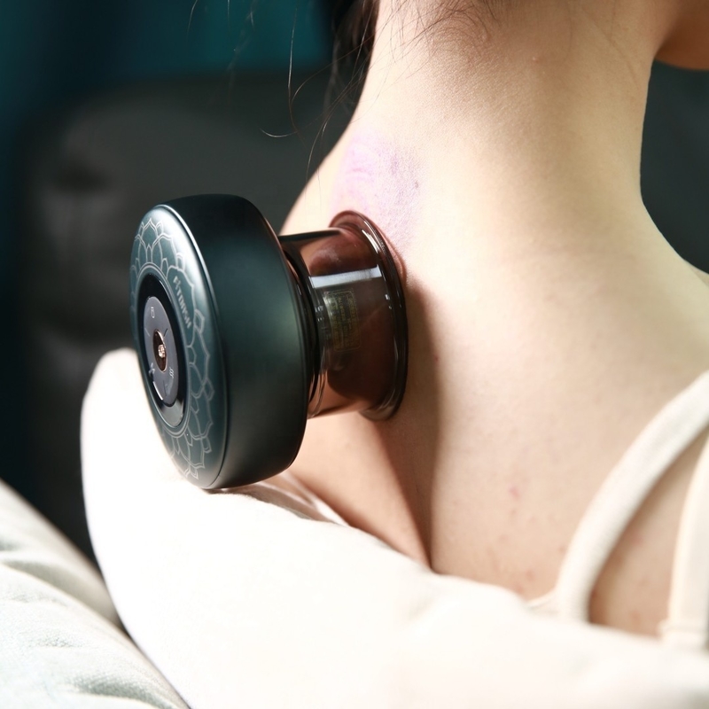 Revoluciona tus sesiones de terapia con el masajeador Fitdash Smart Cupping y Type-C Power