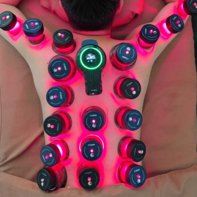 6 Tazas de tamaño y máquina de terapia de vacío de control remoto para el alivio del dolor